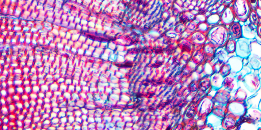 micrograph plant cells of woody dicot stem 