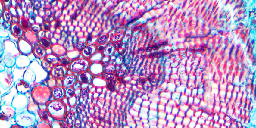 micrograph plant cells of woody dicot stem 